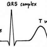 About PQRST in ECG