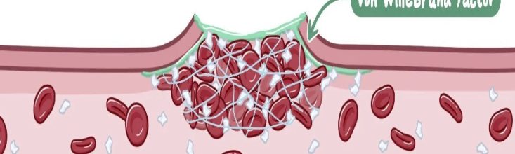 Thrombotic Thrombocytopenic Purpura