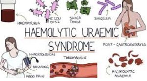 Haemolytic Uremic Syndrome