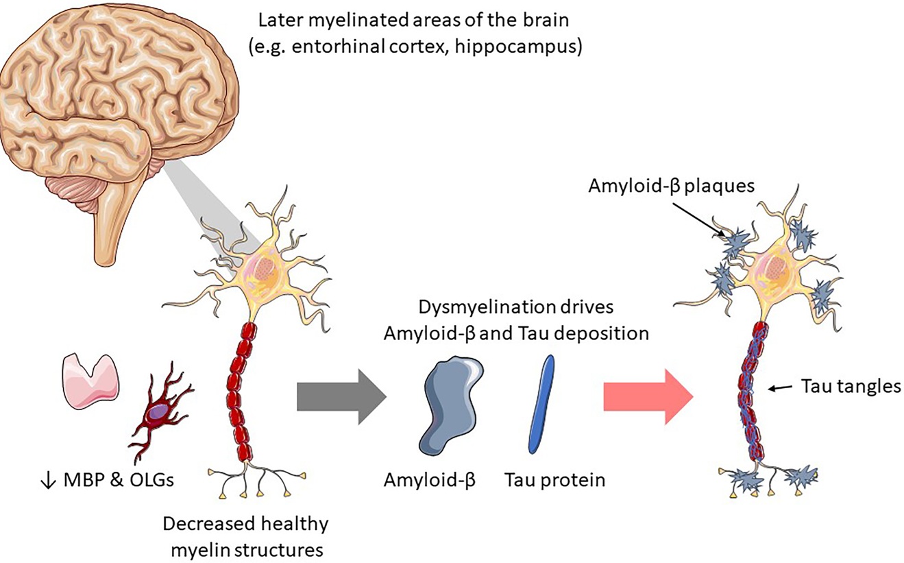 Neurodegeneration